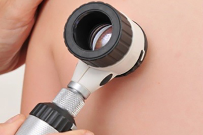 pair of smooth legs after vein treatment